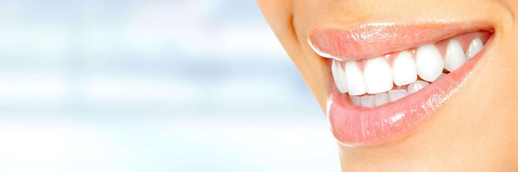 teeth whitening topeka, ks
