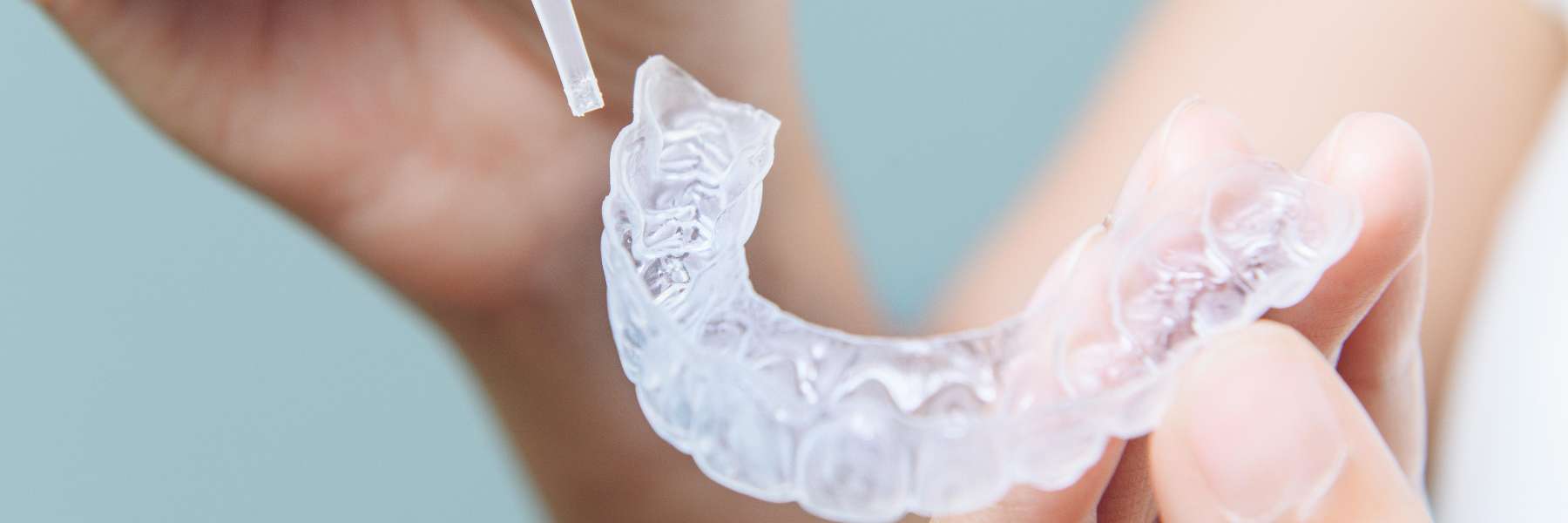  teeth whitening topeka