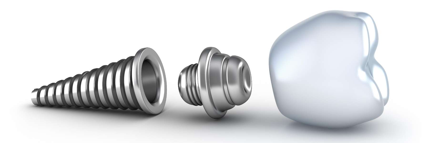 dental implants topeka ks