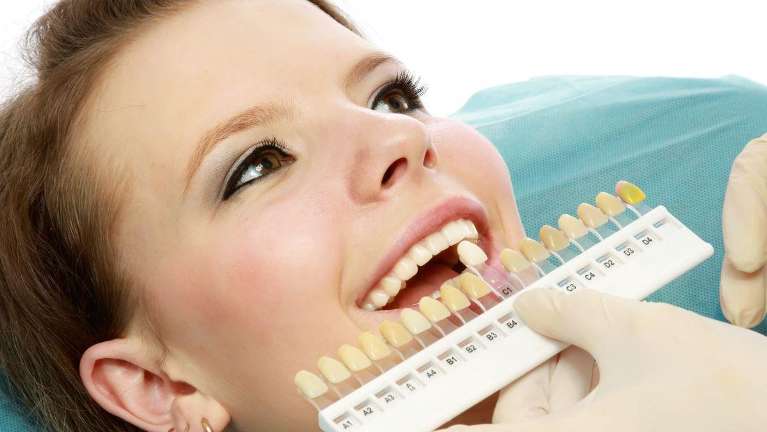 teeth color shades in Topeka, KS