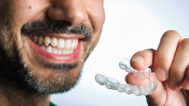 Clear Aligners in Topeka, KS